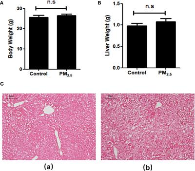 PM2.5 induced liver lipid metabolic disorders in C57BL/6J mice